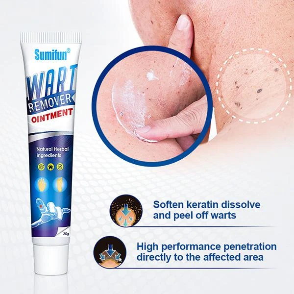 Döyənək, ziyiil və papilloma əleyhinə Sumifun Wart Removal Cream — Mallar, Bakı (3)