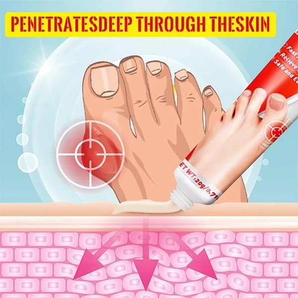 Sumifun Bunion Pain Reliefe Cream podaqra agrıları kəsici krem — Mallar, Bakı (3)