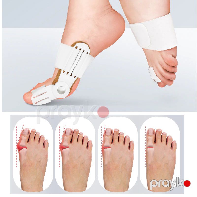2 Ədəd Bunion Korrektoru Qadınlar və Kişilər üçün Hallux Valgus Bunion Böyük Ayaq Barmağı Düzləşdirici Ayaq Braket Yastiqciqlar — Gözəllik və səhiyyə, Bakı (8)