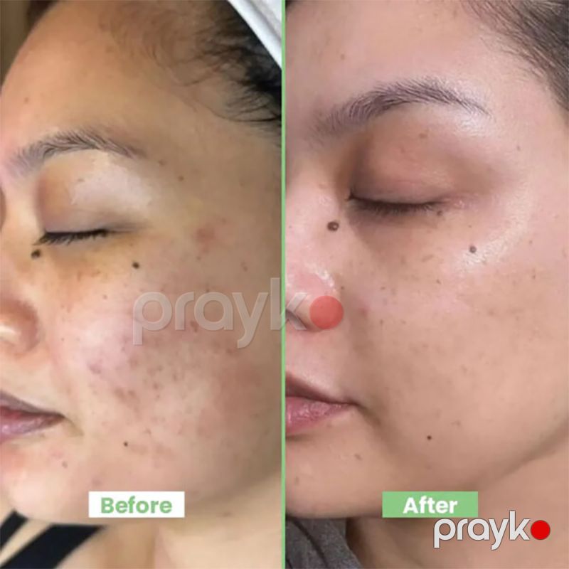 Biocos Arbutin 3% Beauty Cream – Dəri Tonunu Bərabərləşdirən Ağardıcı Krem (40 ml) — Gözəllik və səhiyyə, Bakı (2)