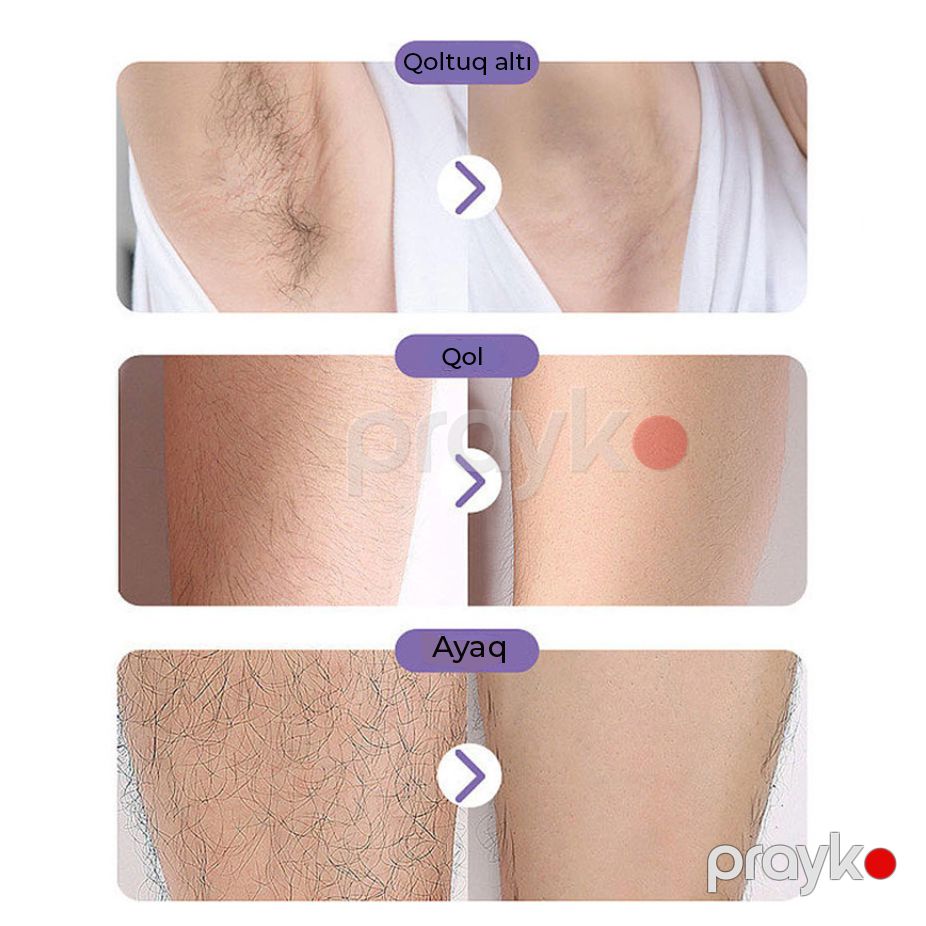Kristal Tük Təmizləyici Fiziki Epilyasiya Aləti Nano Kristal Epilator Kişi Qadın — Gözəllik və səhiyyə, Bakı (5)