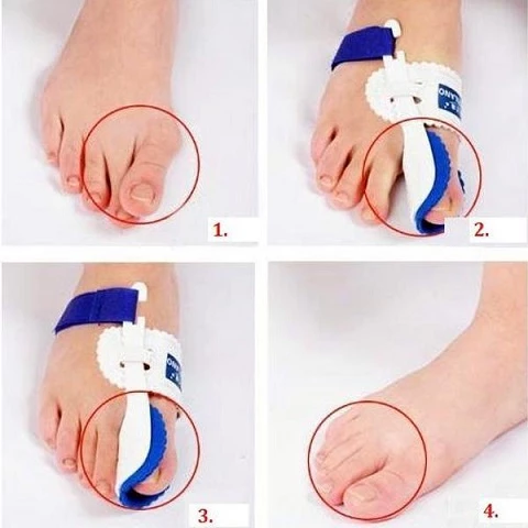 Böyük barmaq üçün (podaqraya görə) gecə fiksatoru Hav Splint Ortofix 2əd — Mallar, Bakı (3)