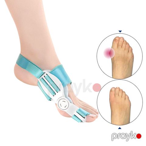 2 Ədəd Ayaq Barmağı Düzləşdirici Hallux Valgus Burion Korrektoru Tənzimlənən Ortopedik Ayaq Barmağı Qoruyucusu — Bakı
