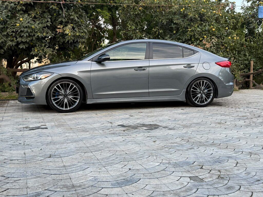 Hyundai Elantra, 1.6 L, 2017 il, 198 271 km 77-ZD-485 — Avtomobillər, Bakı (4)