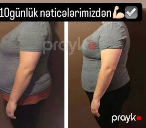 Arıqlama masaji qadinlar ucun - Əziz və dəyərli xanımlar — Masazır