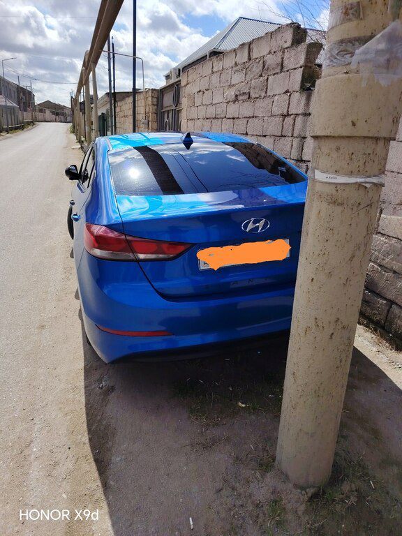 Hyundai Elantra, 2.0 L, 2016 il, 165 440 km 77-SQ-829 — Avtomobillər, Bakı (5)