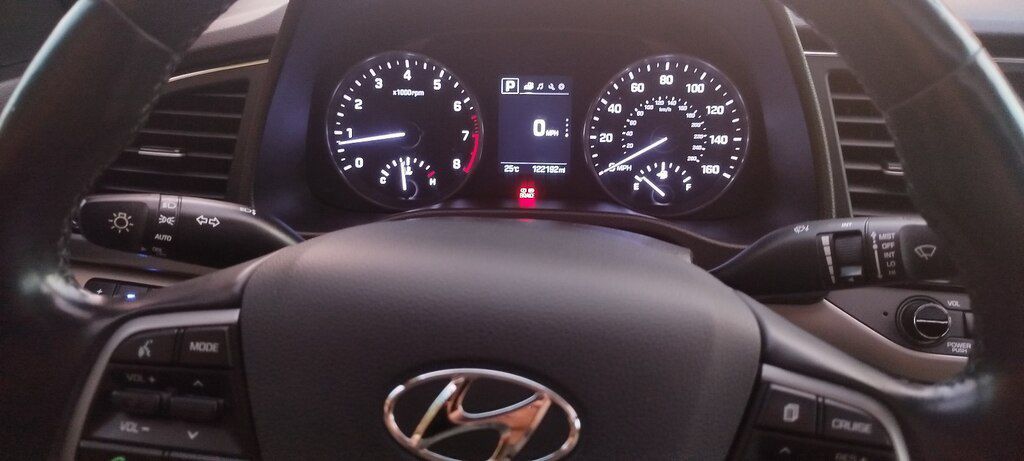 Hyundai Elantra, 2.0 L, 2017 il, 197 000 km — Avtomobillər, Bakı (10)