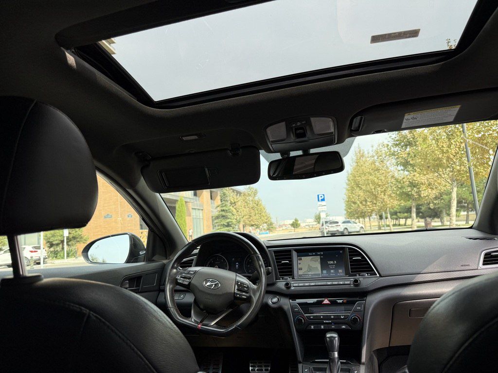 Hyundai Elantra, 1.6 L, 2017 il, 94 000 km — Avtomobillər, Bakı (4)