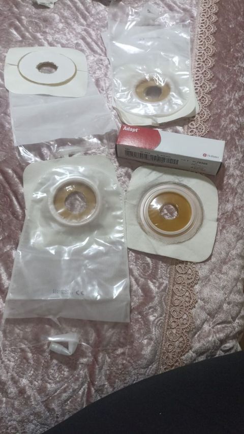 Stoma üçün torbalar və yapışqan əsaslı ostomiya ləvazimatları. Şəkildə — Bakı