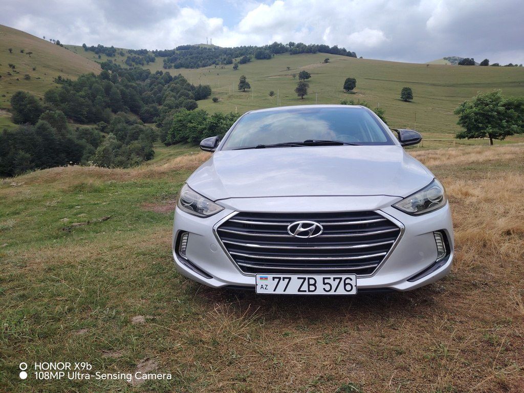 Hyundai Elantra, 2.0 L, 2017 il, 94 098 km 77-ZB-576 — Avtomobillər, Bakı (2)