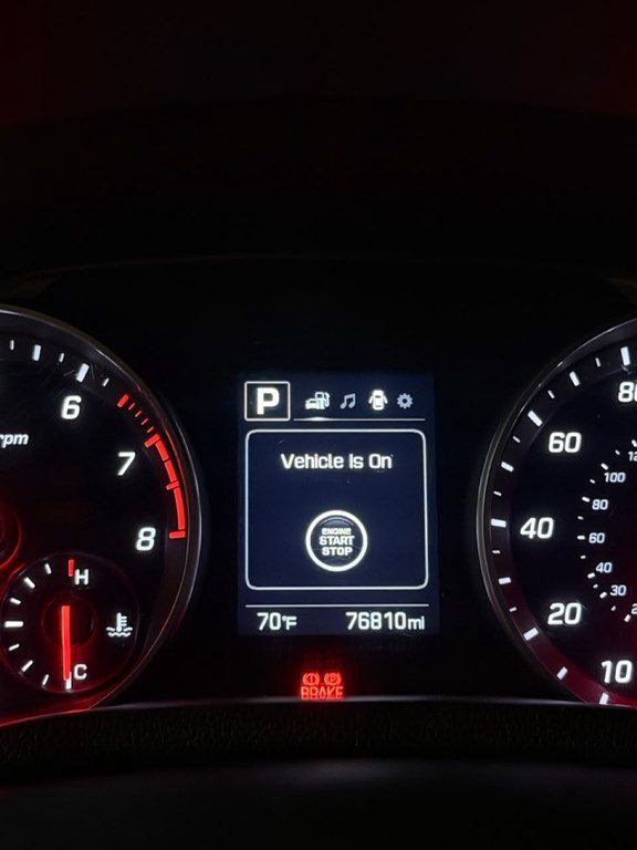 Hyundai Elantra, 1.6 L, 2017 il, 123 919 km — Avtomobillər, Bakı (8)