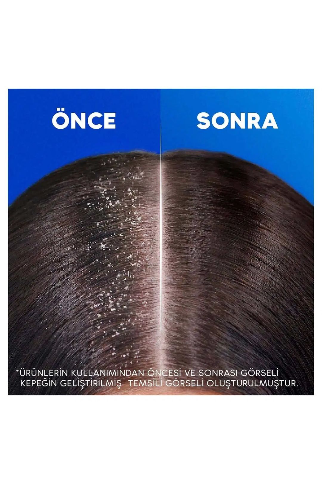 Şampun Head Shoulders Kəpək Əleyhinə Limonlu, 330 ml — Mallar, Bakı (2)