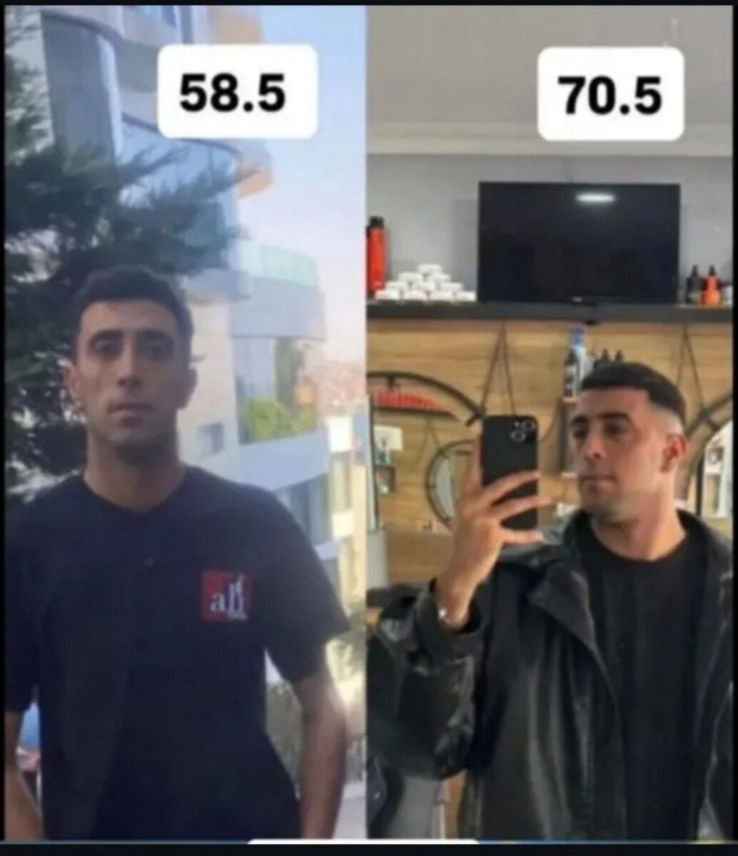 Magic For X5 kökəlmə bitki tozu — Gözəllik və səhiyyə, Bakı (7)
