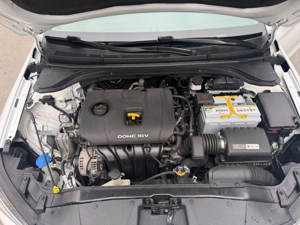 Hyundai Elantra, 2.0 L, 2017 il, 174 178 km 88-DP-351 — Avtomobillər, Bakı (3)
