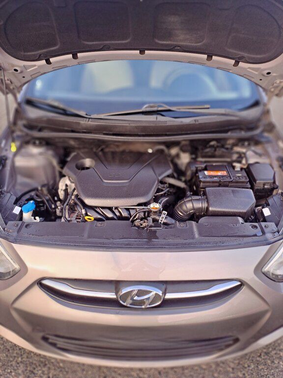 Hyundai Accent, 1.6 L, 2017 il, 173 809 km — Avtomobillər, Bakı (9)