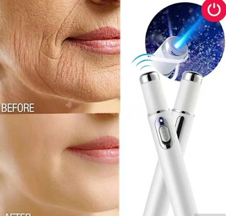Üz qələmi mavi işıq terapiyası sızanaq əleyhinə — 20 ₼ · Üz qayığı Üz qələmi mavi işıq terapiyası sızanaq əleyhinə