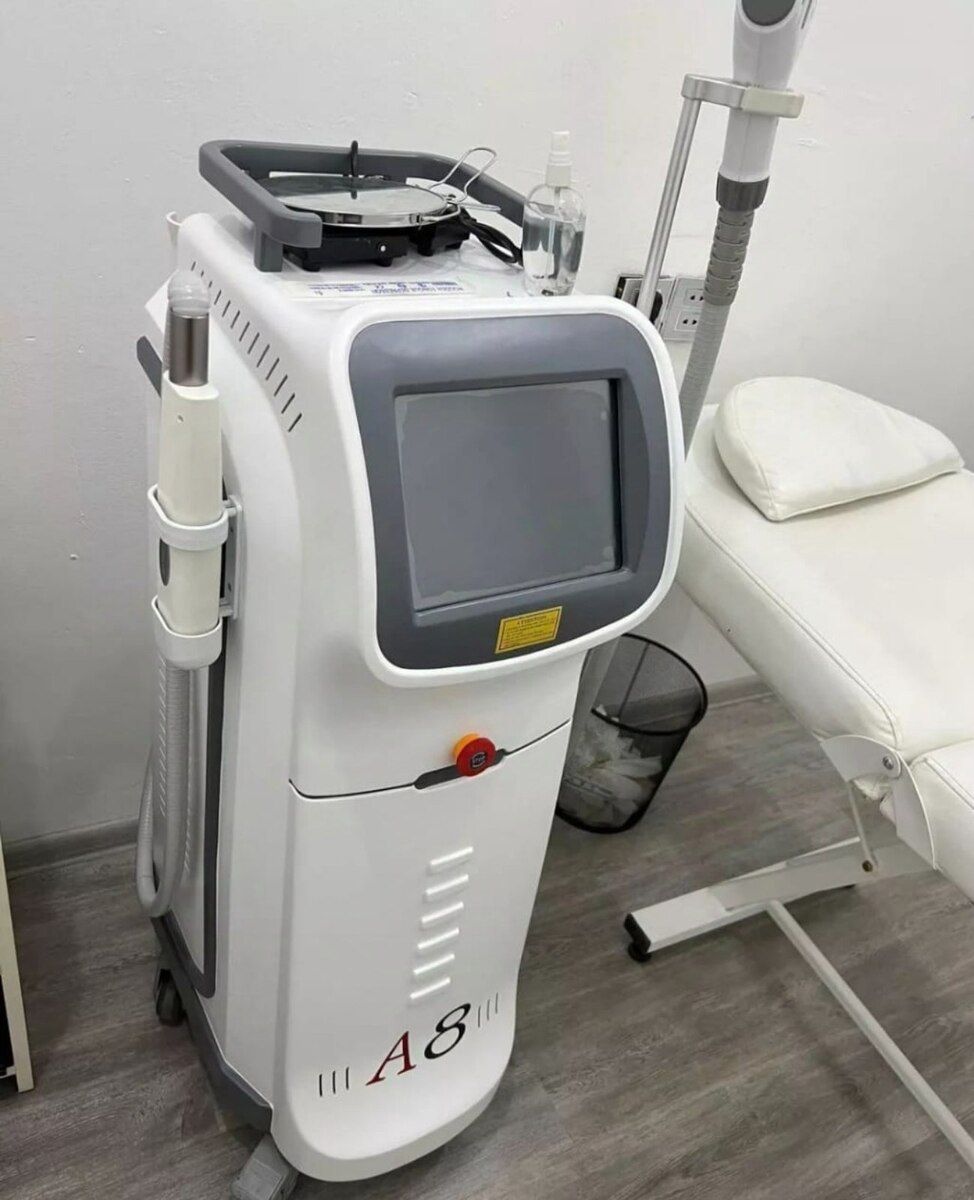 Lazer aparatı — Biznes və avadanlıq, Mingəçevir