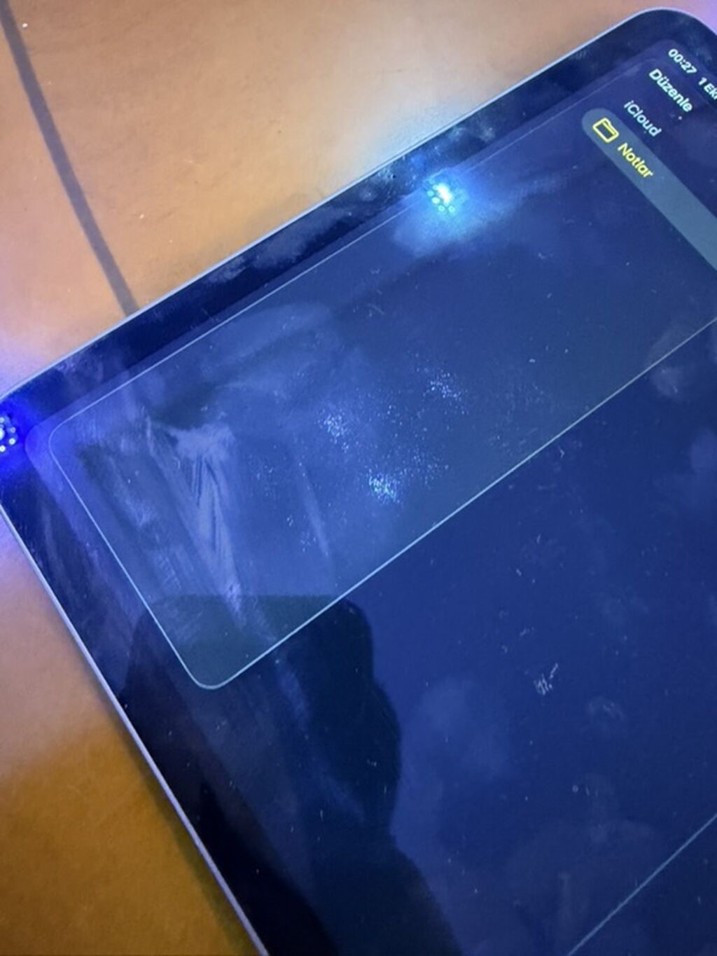 Ekranda balaca piksellər var və zaryatkanı zəif saxlıyır qalan bütün — Apple, Bakı (5)