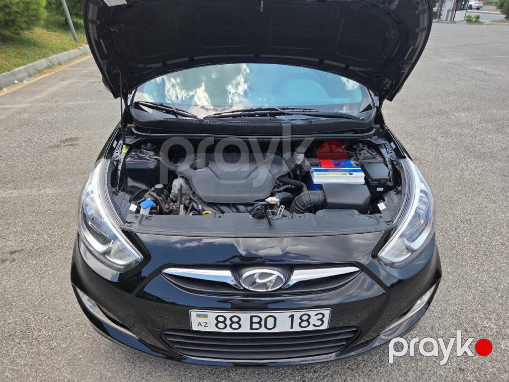 Hyundai Accent, 1.6 L, 2017 il, 121 000 km — Avtomobillər, Bakı (12)