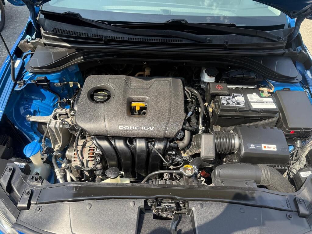 Hyundai Elantra, 2.0 L, 2017 il, 204 186 km — Avtomobillər, Quba (8)