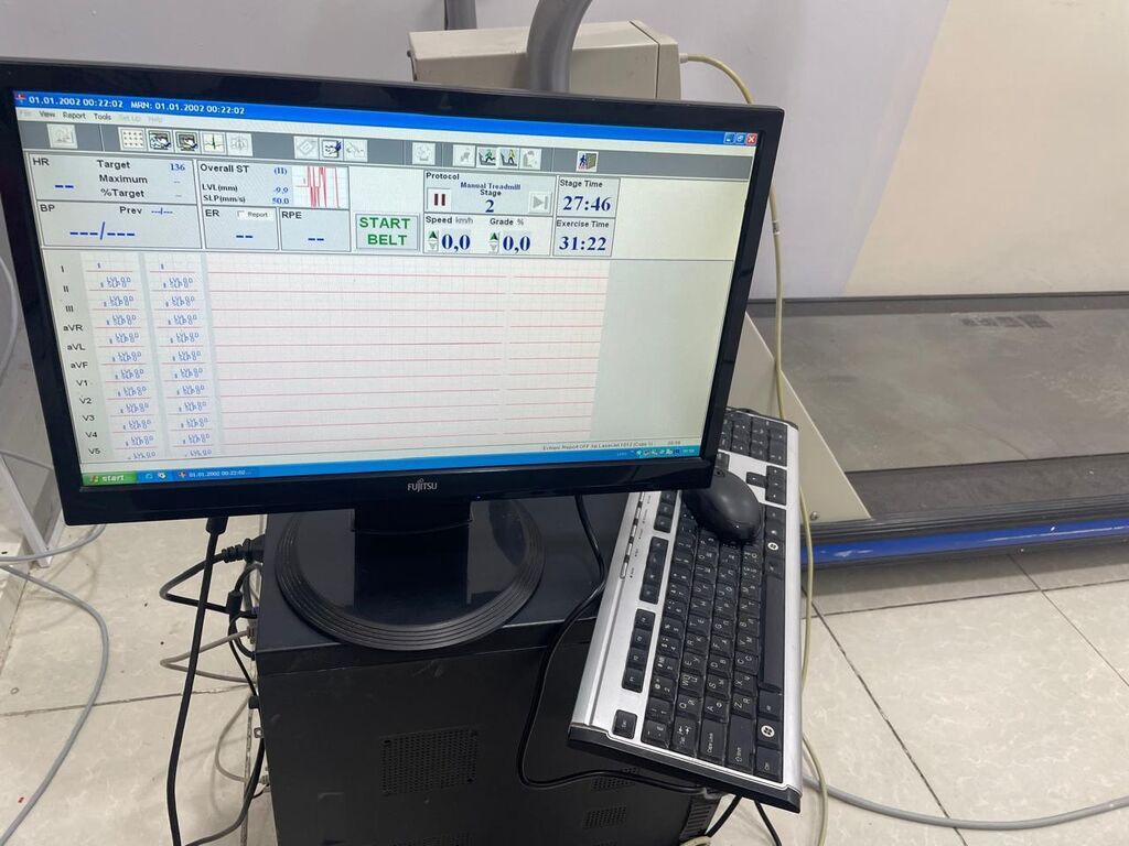 Quinton Q-Stress Treadmill – kardioloji stress-test sistemi Peşəkar — İdman və istirahət, Şəki (6)