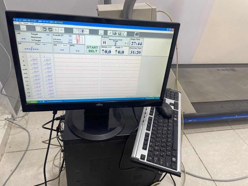 Quinton Q-Stress Treadmill – kardioloji stress-test sistemi Peşəkar — İdman və istirahət, Şəki (3)